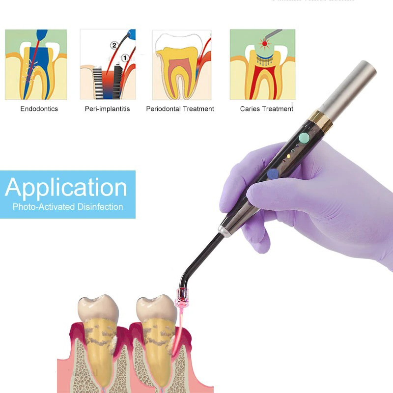 Wireless F3WW Dental Diode Las - đánh giá và giá Diode Laser Module